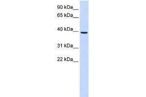 Image no. 1 for anti-Monoacylglycerol O-Acyltransferase 2 (MOGAT2) (Middle Region) antibody (ABIN2783968)