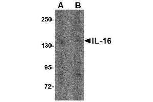 Image no. 2 for anti-Interleukin 16 (IL16) (N-Term) antibody (ABIN499974)