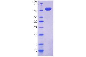 Image no. 1 for CD164 (CD164) (AA 24-162) protein (GST tag,His tag) (ABIN6239042)