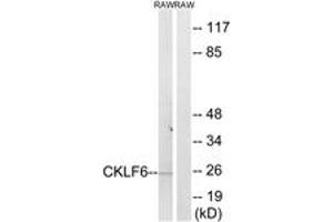 Image no. 1 for anti-CKLF-Like MARVEL Transmembrane Domain Containing 6 (CMTM6) (AA 131-180) antibody (ABIN2890222)