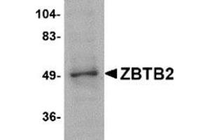 Image no. 1 for anti-Zinc Finger and BTB Domain Containing 2 (ZBTB2) (Center) antibody (ABIN501149)