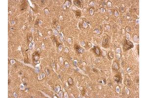 IHC-P Image Synaptophysin antibody detects Synaptophysin protein at on rat fore brain by immunohistochemical analysis.