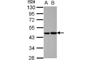 Image no. 2 for anti-Vitamin K-dependent protein C (PROC) (AA 1-236) antibody (ABIN1500426)