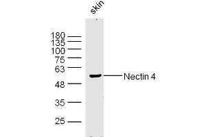 Image no. 2 for anti-Poliovirus Receptor-Related 4 (PVRL4) (AA 151-250) antibody (ABIN1387848)