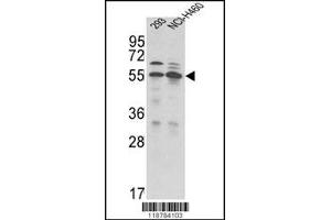 Image no. 2 for anti-Transmembrane Protease, serine 2 (TMPRSS2) (N-Term) antibody (ABIN2496998)