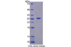 Image no. 1 for BCL2-Associated Athanogene (BAG1) protein (ABIN6119567)