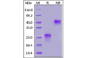 Image no. 2 for Placenta Growth Factor (PGF) (AA 19-149) (Active) protein (His tag) (ABIN6973196)