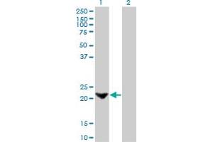 Image no. 1 for anti-Transgelin (TAGLN) (AA 1-201) antibody (ABIN520664)