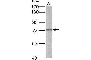 Image no. 2 for anti-Strawberry Notch Homolog 1 (SBNO1) (Center) antibody (ABIN2856024)