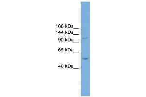 Image no. 1 for anti-TNNI3 Interacting Kinase (TNNI3K) (N-Term) antibody (ABIN632533)
