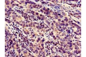 LOXHD1 anticorps  (AA 1101-1366)