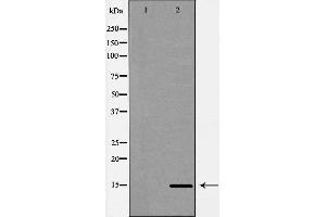 Image no. 2 for anti-Cytochrome B5 Type A (Microsomal) (CYB5A) (Internal Region) antibody (ABIN6261133)