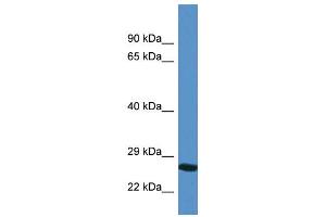 Image no. 2 for anti-Yip1 Domain Family, Member 4 (YIPF4) (N-Term) antibody (ABIN2788486)