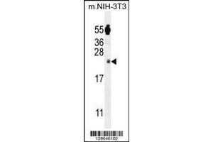 anti-Family with Sequence Similarity 96, Member A (FAM96A) (AA 109-138), (C-Term) antibody