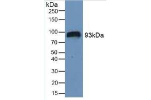 Rabbit Detection antibody from the kit in WB with Positive Control: Sample Human Serum.