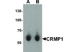 CRMP1 antibody  (C-Term)