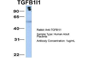 Image no. 6 for anti-Transforming Growth Factor beta 1 Induced Transcript 1 (TGFB1I1) (Middle Region) antibody (ABIN2777947)