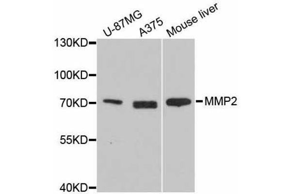 MMP2 抗体  (AA 40-280)