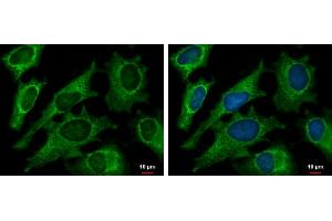 Image no. 5 for anti-2,4-Dienoyl CoA Reductase 1, Mitochondrial (DECR1) (full length) antibody (ABIN2856693)