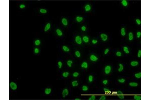 ARID1B antibody  (AA 1364-1460)