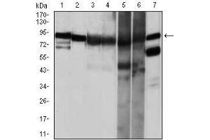 Image no. 4 for anti-Heat Shock Protein 90kDa alpha (Cytosolic), Class A Member 1 (HSP90AA1) antibody (ABIN969528)