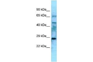 Image no. 1 for anti-Eyes Absent Homolog 4 (EYA4) (N-Term) antibody (ABIN2778551)