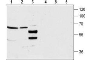 Western blot analysis of rat brain lysate (lanes 1 and 4), mouse brain membrane (lanes 2 and 5) and human CCF-STGI Brain astrocytoma cell line lysate (lanes 3 and 6): - 1-3.