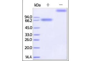 Image no. 1 for Interleukin 21 Receptor (IL21R) (AA 20-236) (Active) protein (Fc Tag) (ABIN2181374)