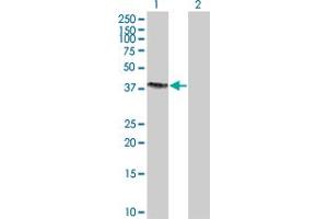 Image no. 1 for anti-Sorting Nexin 15 (SNX15) (AA 1-342) antibody (ABIN526149)