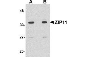Western Blotting (WB) image for anti-Solute Carrier Family 39 (Metal Ion Transporter), Member 11 (SLC39A11) (Middle Region) antibody (ABIN1031177)