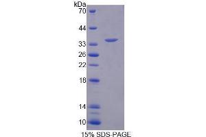 Image no. 1 for Replication Factor C (Activator 1) 2, 40kDa (RFC2) (AA 58-332) protein (His tag) (ABIN6239666)