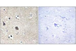 Image no. 2 for anti-Midline 1 (MID1) (AA 71-120) antibody (ABIN1533497)