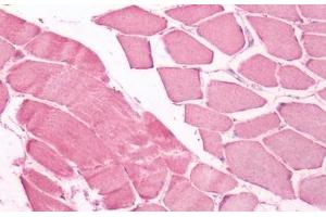 Human Skeletal Muscle: Formalin-Fixed, Paraffin-Embedded (FFPE)