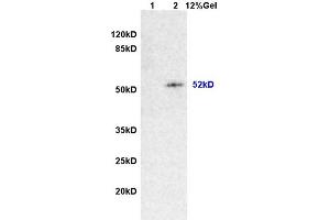 Image no. 1 for anti-Desmin (DES) (AA 261-360) antibody (ABIN736566)