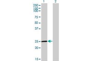 Image no. 4 for anti-Twist Homolog 1 (Drosophila) (TWIST1) (AA 100-202) antibody (ABIN521166)