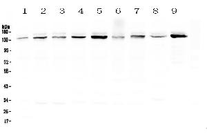 Image no. 1 for anti-Ubiquitin Specific Peptidase 7 (Herpes Virus-Associated) (USP7) (AA 258-483) antibody (ABIN5693267)