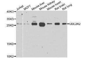 Image no. 2 for anti-Ubiquitin-Conjugating Enzyme E2R 2 (UBE2R2) antibody (ABIN6149821)
