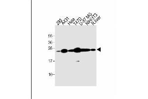 Image no. 2 for anti-RAB1B, Member RAS Oncogene Family (RAB1B) (AA 166-194), (C-Term) antibody (ABIN657731)