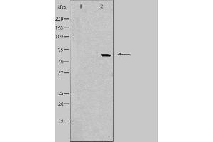 Image no. 1 for anti-Follistatin (FST) (Internal Region) antibody (ABIN6258242)
