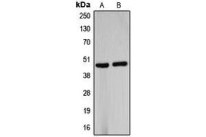 Image no. 1 for anti-UDP-Gal:betaGlcNAc beta 1,4- Galactosyltransferase, Polypeptide 5 (B4GALT5) (C-Term) antibody (ABIN2704515)