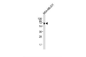 Image no. 3 for anti-5'-Nucleotidase, Ecto (CD73) (NT5E) antibody (ABIN1882218)