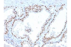 Image no. 3 for anti-Ret Proto-Oncogene (RET) (AA 702-848) antibody (ABIN6940506)