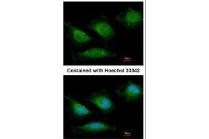 ICC/IF Image Immunofluorescence analysis of methanol-fixed HeLa, using DNA polymerase gamma, antibody at 1:200 dilution.