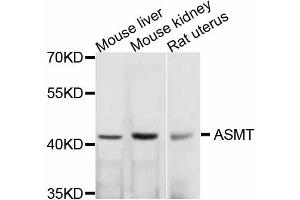 Image no. 1 for anti-Acetylserotonin O-Methyltransferase (ASMT) antibody (ABIN4902958)