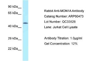 Image no. 1 for anti-MON1 Homolog A (MON1A) (N-Term) antibody (ABIN2788457)
