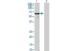 Western Blot analysis of L3MBTL4 expression in transfected 293T cell line by L3MBTL4 monoclonal antibody (M01), clone 1B9-1C12.