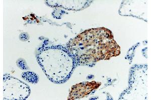 Image no. 1 for anti-HLA Class I Histocompatibility Antigen, alpha Chain G (HLAG) antibody (ABIN94366)