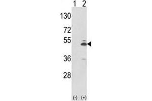 Image no. 3 for anti-Pyruvate Kinase M2 (PKM2) (AA 116-145) antibody (ABIN3032239)