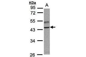Image no. 2 for anti-TNF Receptor-Associated Factor 1 (TRAF1) (Center) antibody (ABIN2855374)