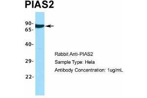 Image no. 2 for anti-Protein Inhibitor of Activated STAT, 2 (PIAS2) (C-Term) antibody (ABIN2776423)